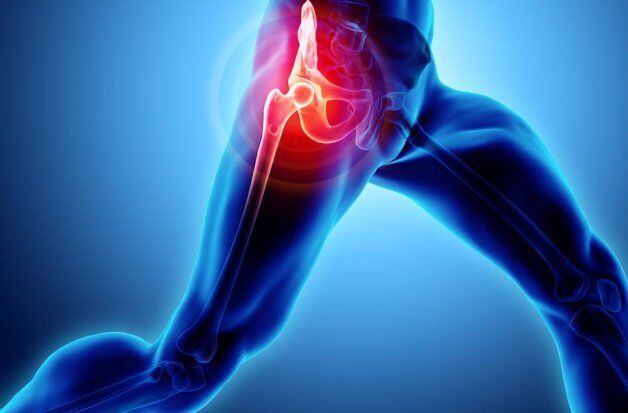 csípő fájdalom mozgás közben elviselhetetlen térdfájdalom